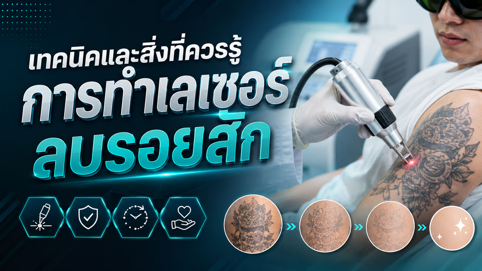 เทคนิคและสิ่งที่ควรรู้ การทำเลเซอร์ลบรอยสัก