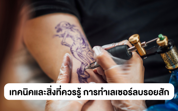 ทำเลเซอร์ลบรอยสัก